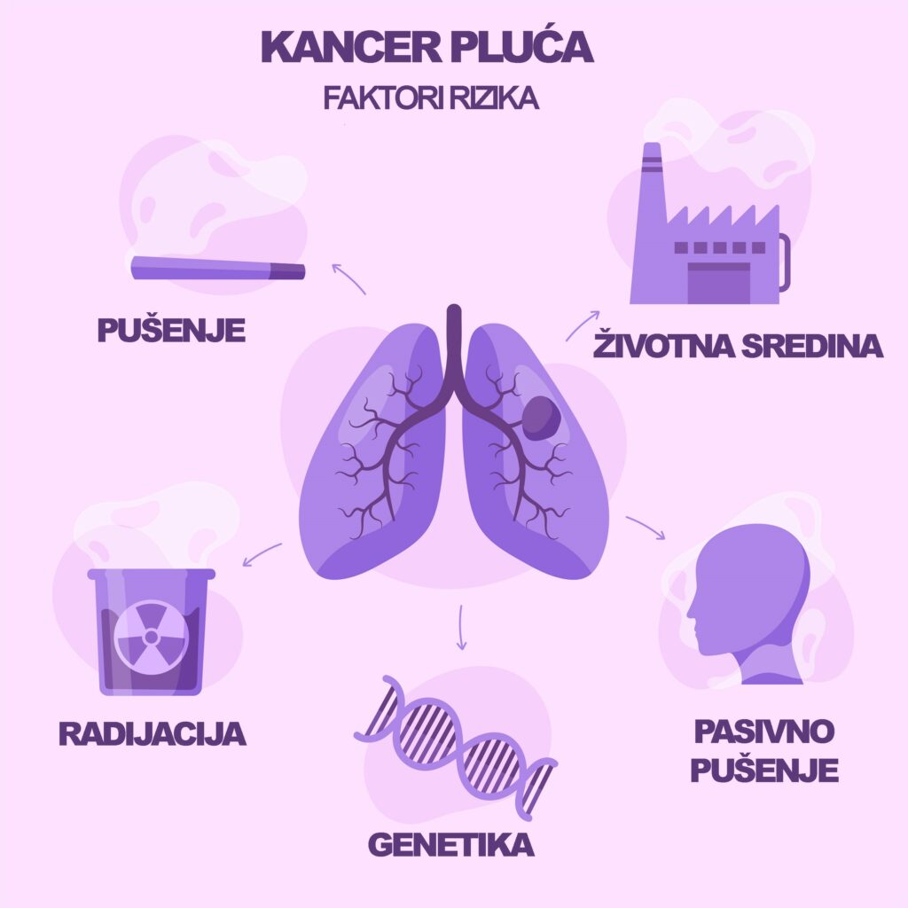 Rak pluća simptomi, faktori rizika i dijagnoza 2