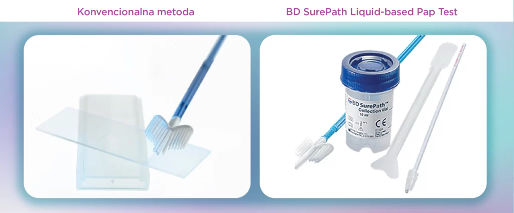 BD SurePath Liquid-based Pap Test 2